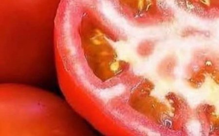 Brighten Your Smile Naturally