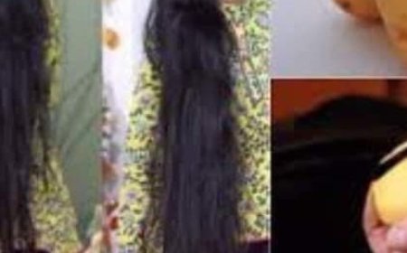 Hair Grows Like Crazy and Doesn’t Fall Out! Discover the Powerful Potato Recipe