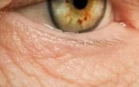 Unbelievable!???? I Have 100% Restored My Vision! Effective Drink for Vision (Parsley