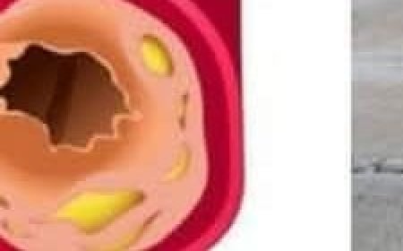 Only a Glass of This Juice Will Remove Clogged Arteries and Control Blood Pressure – Garlic, Lemon, and Apple Cider Vinegar