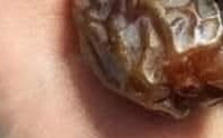 The Delightful Perks: Improve Your Health by Eating Two Dates Daily