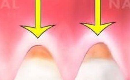 Why Turmeric is Fantastic for Oral Health and Hygiene