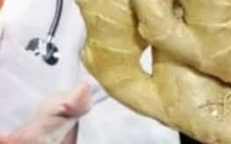 Grandma’s Ginger Remedy: A Natural Cleanser for Liver and Lungs