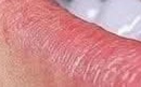 How to Naturally Whiten Your Teeth at Home in Just 3 Minutes