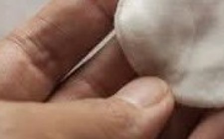 Age Spot Lightening with Apple Cider Vinegar