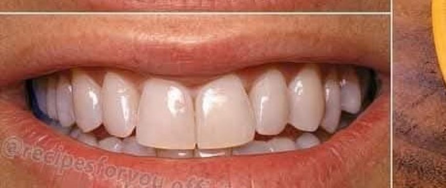 Quick Teeth Whitening with Banana Peels: Transform Yellow Teeth to Shiny White in Just 2 Minutes