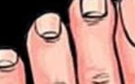 Bay Leaf Remedy for Bunion Relief Salah Recipes By Salah Recipes Published November 3, 2024