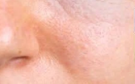 Mix Parsley and Vaseline: The Best Collagen Mask for Glowing, Youthful Skin