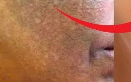 Vaseline with Lemon and you will be shocked