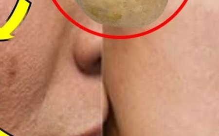 Natural Glow: Banishing Sun Spots With Potato And Cinnamon