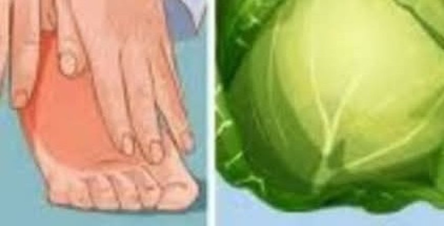 Amazing! Get Rid of Varicose Veins – Just Put These Leaves Over and Wait!