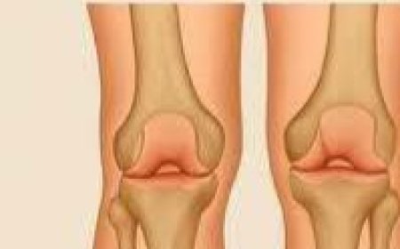 MIRACLE COFFEE prevents dementia, heart attack and stroke, joint arthrosis… recipe