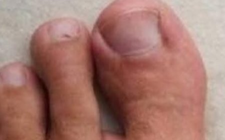 7 Early Warning Signs of a Heart Attack You Shouldn’t Ignore