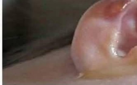 Put 2 drops in your ear and you will hear like before. Recover your hearing.