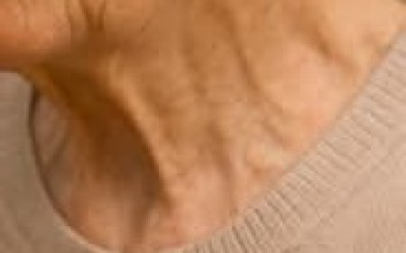 A Natural Kidney Treatment That May Restore Function and Remove Kidney Stones