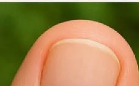 Discover the Miracle Solution That Permanently Kills Toenail Fungus!