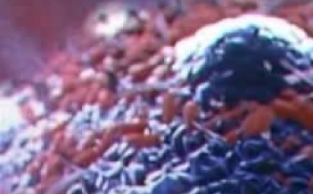 8 Powerful Anti-Cancer Foods You Should Add to Your Diet