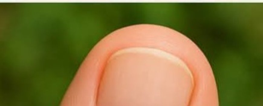 Discover the Miracle Solution That Permanently Kills Toenail Fungus!