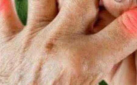 The Powerful Plant That May Support Cancer Treatment: A Closer Look at the Benefits of the Greater Burdock Root