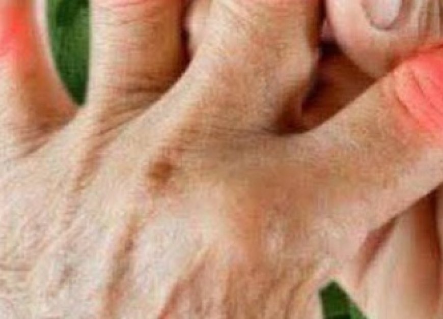 The Powerful Plant That May Support Cancer Treatment: A Closer Look at the Benefits of the Greater Burdock Root
