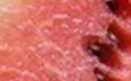 Why You Should Throw Out a Watermelon If You See This Inside