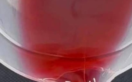 Natural Drink to Eliminate Type 2 Diabetes, High Cholesterol, Obesity, Poor Circulation, Arthritis, Fatty Liver, and More