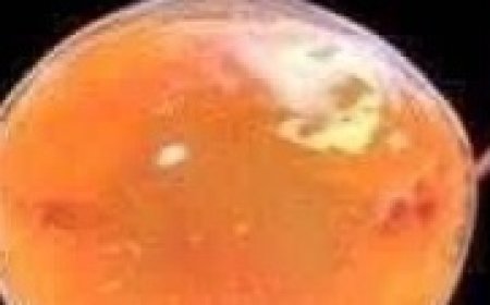 Peeing in the Shower, Doctor Explains Why Women Shouldn’t