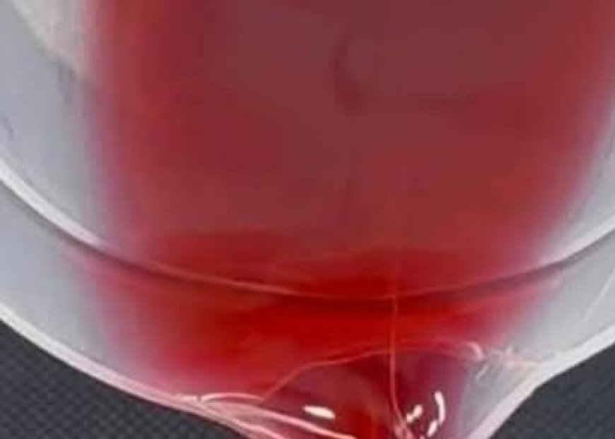 Natural Drink to Eliminate Type 2 Diabetes, High Cholesterol, Obesity, Poor Circulation, Arthritis, Fatty Liver, and More