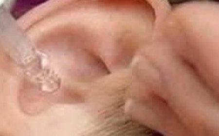 Put 2 drops in your ear and you will hear like before. Recover your hearing