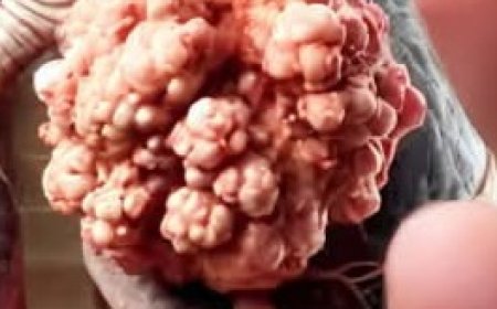 Onions: A Simple Kitchen Ingredient with Remarkable Wellness Benefits