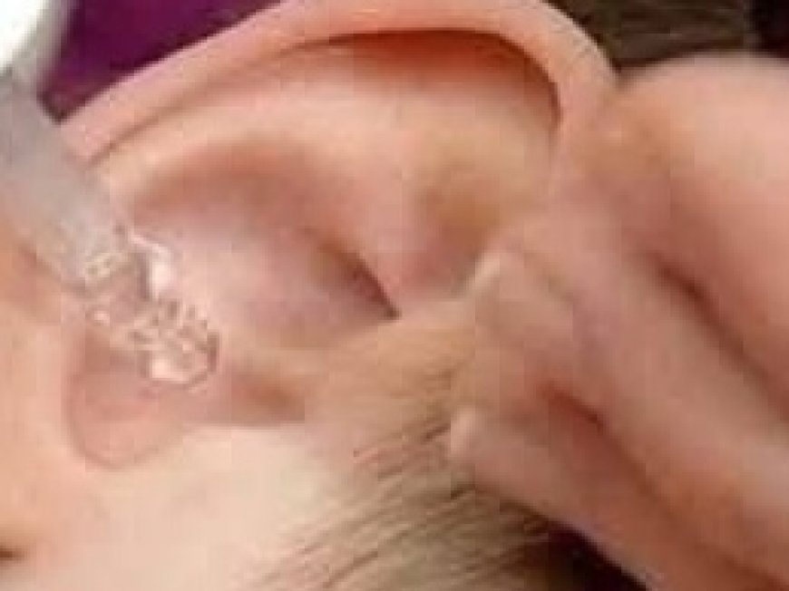 Put 2 drops in your ear and you will hear like before. Recover your hearing