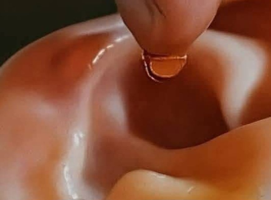 Natural Remedies for Earache & Ear Infections